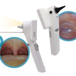 Digital Otoscope EOC700