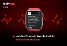 Apple Watch ช่วยชีวิตคนไว้อีกครั้ง หลังเตือนผู้ใช้รายหนึ่งเกี่ยวกับเนื้องอกร้ายแรง Afib