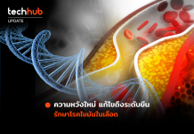 ความหวังใหม่ แก้ไขถึงระดับยีน รักษาโรคไขมันในเลือด โรคไขมันในเลือด