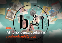 AI รักษาอัลไซเมอร์ 
