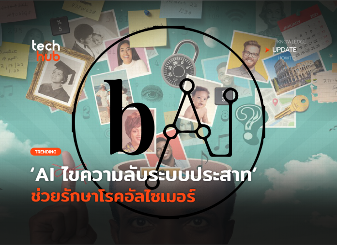 AI รักษาอัลไซเมอร์ 