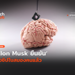 ปลอดภัยจริง Elon Musk ยืนยัน ฝั่งชิปในสมองคนแล้ว -16