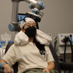 injectable-implants-1-