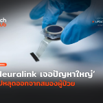 Neuralink เจอปัญหาใหญ่ ชิปหลุดออกจากสมองผู้ป่วย-32