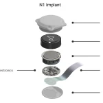 n1_implant_exploded