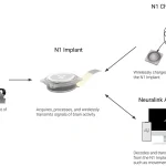 robot_implant_workflow