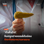 ทำสำเร็จ จีนปลูกถ่ายเซลล์ตับอ่อน รักษาโรคเบาหวานหายขาด-59