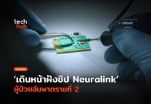 ทดสอบต่อ เดินหน้าฝังชิป Neuralink ผู้ป่วยอัมพาตรายที่ 2
