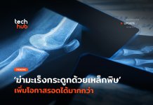 งานวิจัยใหม่ ฆ่า มะเร็งกระดูก ด้วยเหล็กพิษ เพิ่มโอกาสรอดได้มากกว่า