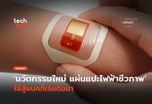 นวัตกรรมใหม่ แผ่นแปะไฟฟ้า ชีวภาพ ใช้สู้แบคทีเรียดื้อยา แผ่นแปะไฟฟ้า