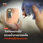 ไม่ต้องเจาะนิ้ว ตรวจน้ำตาลจากเหงื่อ ทางเลือกผู้ป่วยเบาหวาน-35