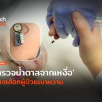 ไม่ต้องเจาะนิ้ว ตรวจน้ำตาลจากเหงื่อ ทางเลือกผู้ป่วยเบาหวาน-36