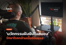 ฝังชิปในสมอง