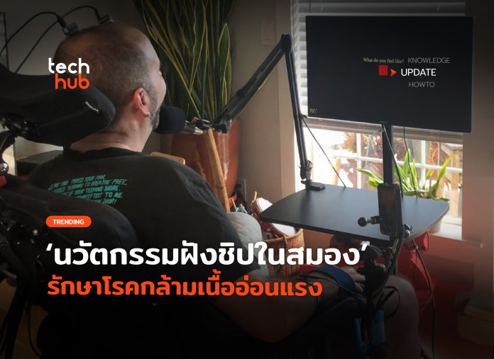 ฝังชิปในสมอง