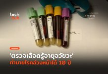 ตรวจเลือดรู้อายุอวัยวะ