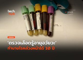 ตรวจเลือดรู้อายุอวัยวะ