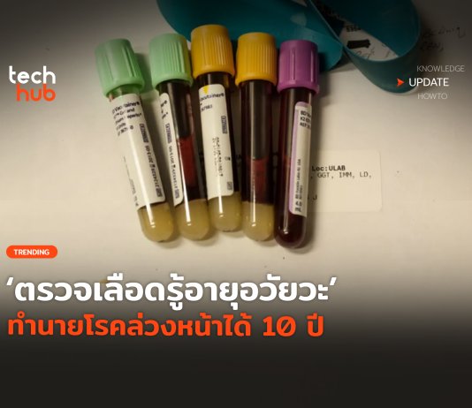 ตรวจเลือดรู้อายุอวัยวะ