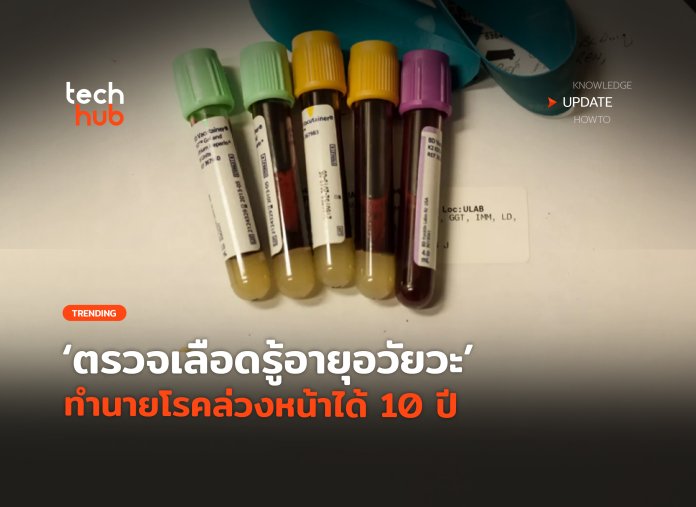 ตรวจเลือดรู้อายุอวัยวะ