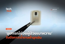 ผู้ป่วยเบาหวาน