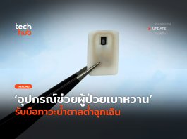 ผู้ป่วยเบาหวาน