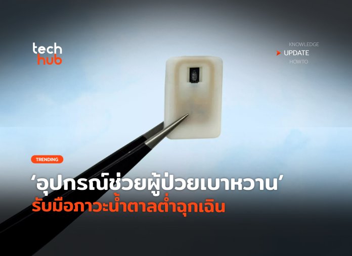 ผู้ป่วยเบาหวาน