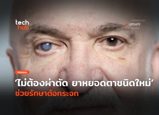 ไม่ต้องผ่าตัด ยาหยอดตาชนิดใหม่ ช่วยรักษาต้อกระจก ยาหยอดตาชนิดใหม่