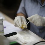 07_ชุดตรวจหาโปรตีนในปัสสาวะ (urine dipstick) เพื่อคัดกรองโรคไต