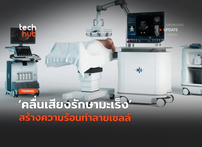 คลื่นเสียงรักษามะเร็ง