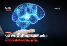 AI พลิกวงการ พบ พื้นที่สมองซ่อนเร้น ช่วยเข้าใจโรคได้มากขึ้น พื้นที่สมองซ่อนเร้น