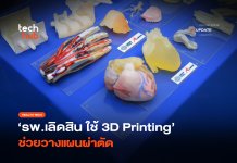 แม่นยำกว่าเดิม รพ.เลิดสิน ใช้ 3D Printing ช่วยวางแผนผ่าตัด