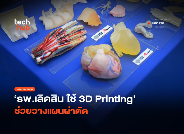 แม่นยำกว่าเดิม รพ.เลิดสิน ใช้ 3D Printing ช่วยวางแผนผ่าตัด-10