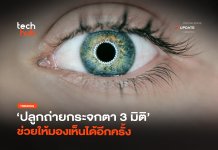 ความหวังใหม่ ปลูกถ่ายกระจกตา 3 มิติ ช่วยให้มองเห็นได้อีกครั้ง ปลูกถ่ายกระจกตา