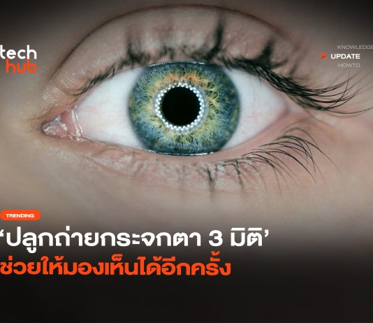 ปลูกถ่ายกระจกตา