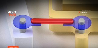 เส้นเอ็นเทียม