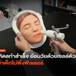 มหิดลทำสำเร็จ ย้อนวัยด้วยเซลล์ตัวเอง หน้าเด็กไม่พึ่งฟิลเลอร์-34
