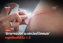 รักษาเองได้ ผงสเปรย์ปิดแผล หยุดเลือดได้ใน 1 วิ