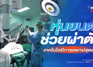 หุ่นยนต์ช่วยผ่าตัด : HealthTech Insight