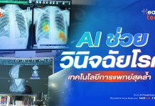 AI ช่วยวินิจฉัยโรค : HealthTech Insight