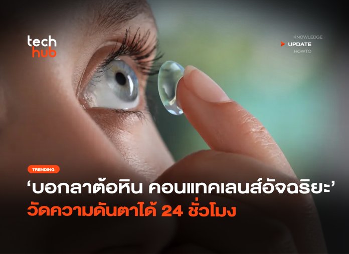 คอนแทคเลนส์อัจฉริยะ