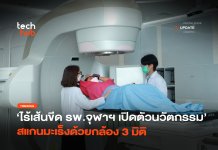 ไร้เส้นขีด รพ.จุฬาฯ เปิดตัวนวัตกรรม สแกนมะเร็งด้วยกล้อง 3 มิติ สแกนมะเร็งด้วยกล้อง 3 มิติ