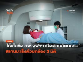 ไร้เส้นขีด รพ.จุฬาฯ เปิดตัวนวัตกรรม สแกนมะเร็งด้วยกล้อง 3 มิติ สแกนมะเร็งด้วยกล้อง 3 มิติ