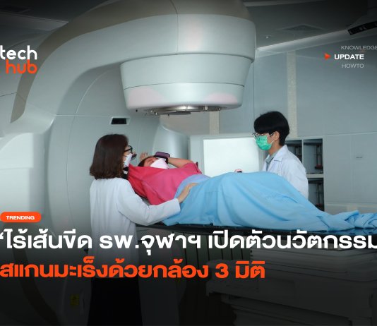 ไร้เส้นขีด รพ.จุฬาฯ เปิดตัวนวัตกรรม สแกนมะเร็งด้วยกล้อง 3 มิติ สแกนมะเร็งด้วยกล้อง 3 มิติ