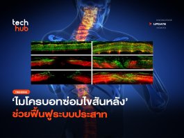 ความหวังใหม่ ไมโครบอทซ่อมไขสันหลัง ช่วยฟื้นฟูระบบประสาท ไมโครบอทซ่อมไขสันหลัง