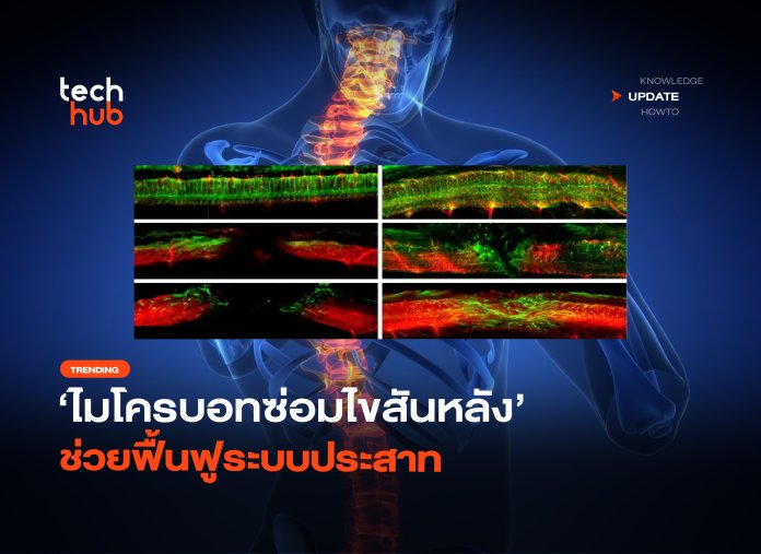 ความหวังใหม่ ไมโครบอทซ่อมไขสันหลัง ช่วยฟื้นฟูระบบประสาท-26 ไมโครบอทซ่อมไขสันหลัง