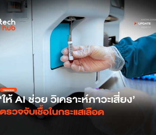 ส่องพลัง AI ตรวจจับเชื้อในกระแสเลือด เซฟชีวิตคนได้จริง AI ตรวจจับเชื้อในกระแสเลือด