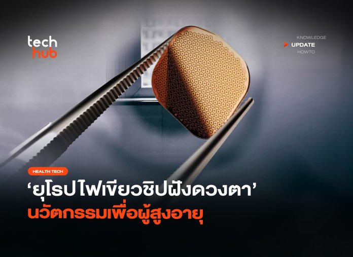 คืนการมองเห็น ยุโรปไฟเขียวชิปฝังดวงตา นวัตกรรมเพื่อผู้สูงอายุ-30 ชิปฝังดวงตา