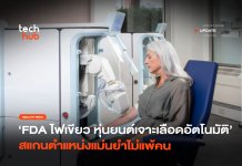 FDA ไฟเขียว หุ่นยนต์เจาะเลือดอัตโนมัติ สแกนตำแหน่งแม่นยำไม่แพ้คน หุ่นยนต์เจาะเลือดอัตโนมัติ