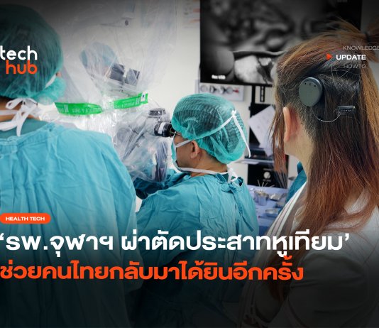 ประสาทหูเทียม