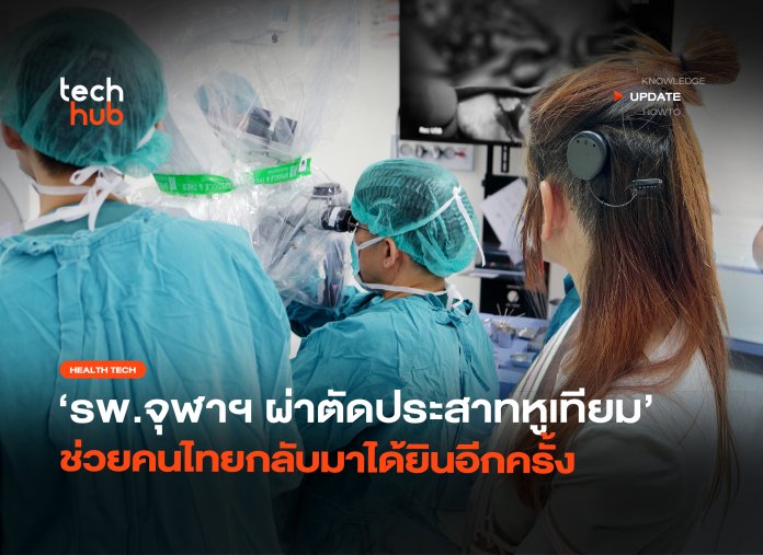 ประสาทหูเทียม