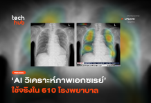 ลบภาพจำ AI นำเข้า เมื่อ AI สัญชาติไทย กำลังช่วยชีวิตคนจริงๆ แล้ว AI สัญชาติไทย